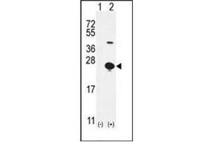 Western blot analysis of EPGN (arrow) using Epigen Antibody (N-term) Cat. (Epigen antibody  (N-Term))