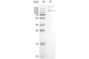 WB analysis of Human T-Nanodisc with anti-Flag monoclonal antibody at 1/5000 dilution, followed by Goat Anti-Rabbit IgG HRP at 1/5000 dilution