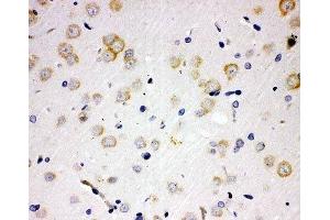IHC-P: PAK6 antibody testing of rat brain tissue (PAK6 antibody  (N-Term))