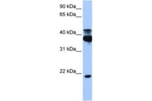 Western Blotting (WB) image for anti-serine/threonine Kinase 38 (STK38) antibody (ABIN2463209) (STK38 antibody)