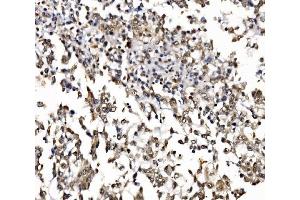 IHC analysis of NOLA1/GAR1 using anti-NOLA1/GAR1 antibody (ABIN7602076). (GAR1 antibody  (AA 58-165))