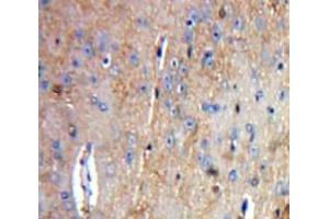 Used in DAB staining on fromalin fixed paraffin-embedded Brain tissue (Tachykinin 3 antibody  (AA 29-101))