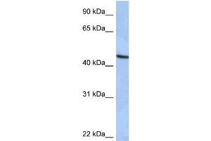 WB Suggested Anti-ZNF766 Antibody Titration:  0. (ZNF766 antibody  (C-Term))