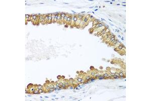 Immunohistochemistry of paraffin-embedded human prostate using LLGL2 antibody. (LLGL2 antibody)
