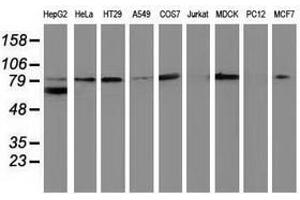 Image no. 2 for anti-Catenin (Cadherin-Associated Protein), beta 1, 88kDa (CTNNB1) antibody (ABIN1496896) (CTNNB1 antibody)