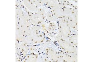 Immunohistochemistry of paraffin-embedded mouse kidney using PTBP1 antibody  at dilution of 1:100 (40x lens). (PTBP1 antibody  (AA 1-290))