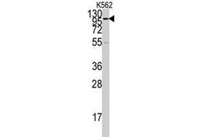 Western blot analysis of ACE2 polyclonal antibody  in K-562 cell lysate (35 ug/lane). (ACE2 antibody  (AA 59-90))