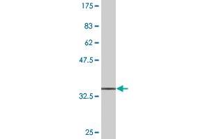 Western Blotting (WB) image for anti-DnaJ (Hsp40) Homolog, Subfamily B, Member 6 (DNAJB6) (AA 72-172) antibody (ABIN523423)