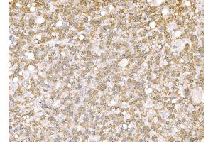 IHC analysis of SND1 using anti-SND1 antibody (ABIN7600526).