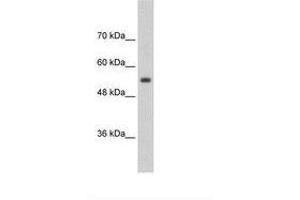 Image no. 2 for anti-Solute Carrier Family 13 Member 3 (SLC13A3) (AA 256-305) antibody (ABIN203375) (SLC13A3 antibody  (AA 256-305))