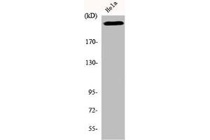 Western Blot analysis of HeLa cells using DNA-PKCS Polyclonal Antibody (PRKDC antibody  (C-Term))