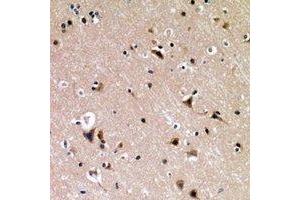 Immunohistochemical analysis of p53 (pS376) staining in human brain formalin fixed paraffin embedded tissue section. (p53 antibody  (C-Term, pSer376))