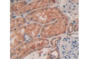 Used in DAB staining on fromalin fixed paraffin- embedded kidney tissue (Col4a4 antibody  (AA 1469-1690))