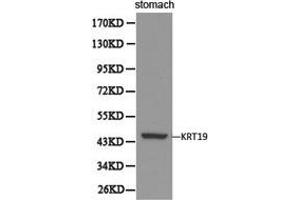 Western Blotting (WB) image for anti-Keratin 19 (KRT19) antibody (ABIN1873481) (Cytokeratin 19 antibody)