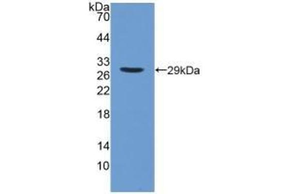 PNPLA2 Antikörper  (AA 484-701)