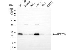 anti-Ubiquitin-Conjugating Enzyme E2E 3 (UBE2E3) antibody