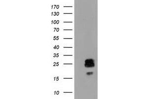 HEK293T cells were transfected with the pCMV6-ENTRY control (Left lane) or pCMV6-ENTRY CLPP (Right lane) cDNA for 48 hrs and lysed. (CLPP antibody)