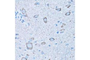 Immunohistochemistry of paraffin-embedded mouse spinal cord using NNMT antibody. (NNMT antibody  (AA 1-264))