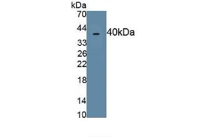 Detection of Recombinant MIP4a, Human using Polyclonal Antibody to Macrophage Inflammatory Protein 4 Alpha (MIP4a) (CCL26 antibody  (AA 24-94))