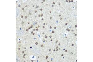 Immunohistochemistry of paraffin-embedded Mouse brain using UB antibody (2359) at dilution of 1:100 (40x lens).