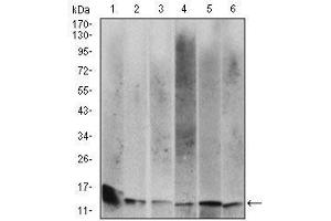 Western blot analysis using B2M mouse mAb against Hela (1), HEK293 (2), HepG2 (3),RAJI (4), A431 (5) and Jurkat (6) cell lysate. (beta-2 Microglobulin antibody  (AA 21-100))