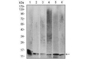 beta-2 Microglobulin antibody  (AA 21-100)