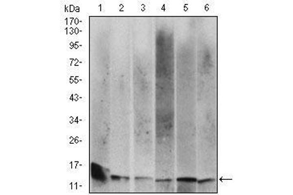 beta-2 Microglobulin 抗体  (AA 21-100)