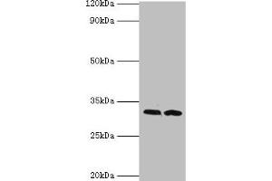 Western blot All lanes: RDM1 antibody at 4 μg/mL Lane 1: PC-3 whole cell lysate Lane 2: MCF-7 whole cell lysate Secondary Goat polyclonal to rabbit IgG at 1/10000 dilution Predicted band size: 32, 30, 16, 14, 29, 26, 9, 13, 19, 27 kDa Observed band size: 32 kDa (RDM1 antibody  (AA 125-284))