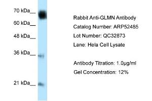 WB Suggested Anti-GLMN Antibody Titration: 0. (GLMN antibody  (C-Term))