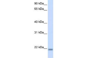 WB Suggested Anti-CNBP Antibody Titration:  0.