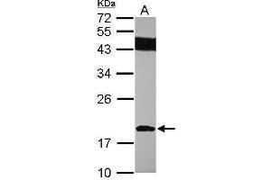 WB Image Sample (30 ug of whole cell lysate) A: IMR32 12% SDS PAGE antibody diluted at 1:1000 (SUMO2 antibody)