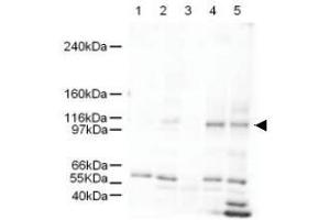 Image no. 1 for anti-SWI/SNF Related, Matrix Associated, Actin Dependent Regulator of Chromatin, Subfamily A-Like 1 (SMARCAL1) (AA 80-96) antibody (ABIN401264)