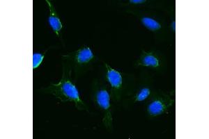 IF analysis of IFT88 using anti-IFT88 antibody (ABIN7600458). (IFT88 antibody  (AA 198-814))