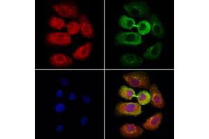 ABIN6264773 and ABIN6278630 staining Hela cells by IF/ICC. (URI1 antibody  (Internal Region))