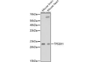 Western blot analysis of extracts of various cell lines, using TP53I11 antibody (ABIN6131365, ABIN6149418, ABIN6149419 and ABIN6216636) at 1:1000 dilution. (TP53I11 antibody  (AA 1-70))