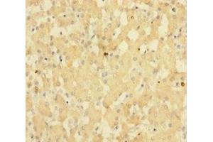 Immunohistochemistry of paraffin-embedded human liver tissue using ABIN7143148 at dilution of 1:100 (SUB1 antibody  (AA 2-127))