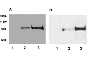Western blot analysis of repetin expression in cytosolic (lane 1), membrane (lane 2) and cytoskeletal (lane 3) extracts from suspension-induced human keratinocytes (A) and human foreskin biopsy (B) using anti-Repetin, pAb (AF646) . (Repetin antibody  (AA 570-584))