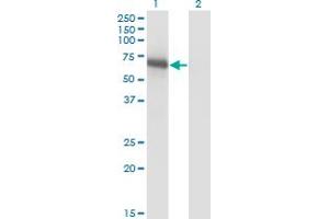 Western Blot analysis of BIN1 expression in transfected 293T cell line by BIN1 monoclonal antibody (M01), clone 1H1. (BIN1 antibody  (AA 355-454))