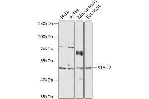 Western blot analysis of extracts of various cell lines, using ST antibody  at 1:1000 dilution. (Double-stranded RNA-binding protein Staufen homolog 2 (STAU2) (AA 300-400) antibody)
