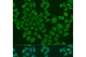 Immunofluorescence analysis of U2OS cells using BLOC1S2 Polyclonal Antibody at dilution of 1:100. (BLOC1S2 antibody)