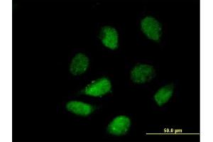 Immunofluorescence of purified MaxPab antibody to HDAC9 on HeLa cell. (HDAC9 antibody  (AA 1-1069))