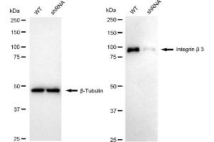 Western blotting analysis using integrin beta 3 antibody (ABIN7799070).