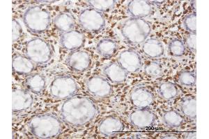 Immunoperoxidase of monoclonal antibody to HCLS1 on formalin-fixed paraffin-embedded human colon. (HCLS1 antibody  (AA 266-355))