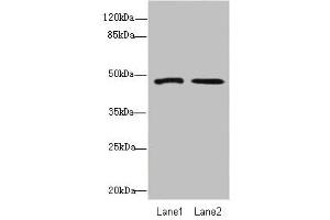 Western blot All lanes: GCM1antibody at 1. (GCM1 antibody  (AA 207-436))