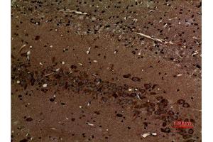 Immunohistochemistry (IHC) analysis of paraffin-embedded Rat Brain, antibody was diluted at 1:100. (Myosin VI antibody  (N-Term))
