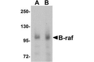 Western blot analysis of B-raf in human brain tissue lysate with B-raf antibody at (A) 1 and (B) 2 μg/ml. (BRAF antibody  (Center))