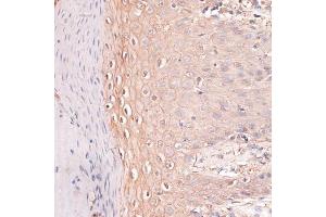 Immunohistochemistry of paraffin-embedded human skin using CDH3 antibody (ABIN7269142) at dilution of 1:100 (40x lens).