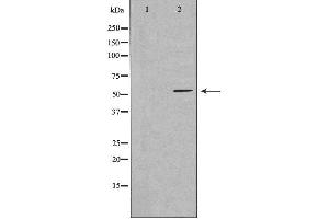 Western blot analysis of extracts from LOVO cells, using CCDC102A antibody.