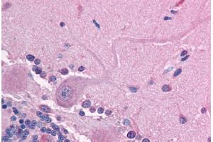 Human Brain, Cerebellum (formalin-fixed, paraffin-embedded) stained with GABRE antibody ABIN214760 at 2. (GABRE antibody  (AA 237-286))