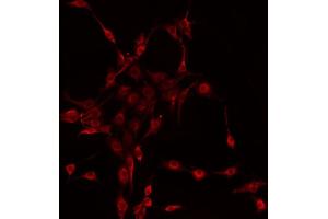 ABIN6272269 staining HeLa by IF/ICC. (CTNNA2 antibody  (C-Term))